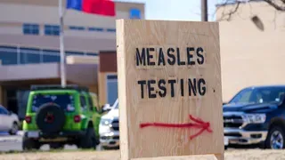 US Measles Cases Rise Slightly as Colorado Reports a New Outbreak